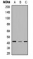 Anti-SCD Antibody