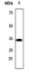 Anti-Carbonic Anhydrase 8 Antibody