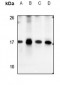 Anti-S100-A7 Antibody