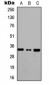 Anti-RagA/B Antibody