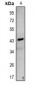 Anti-NDRG3 Antibody