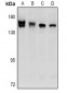 Anti-STK36 Antibody