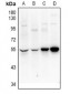 Anti-UEVLD Antibody