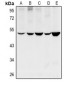 Anti-Cytochrome P450 11B1/2 Antibody