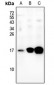 Anti-BLCAP Antibody