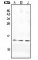 Anti-PKI beta Antibody