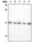 Anti-ECRG4 Antibody