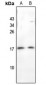 Anti-BAGE3 Antibody