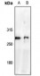 Anti-NAV2 Antibody