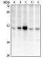 Anti-CCDC109A Antibody