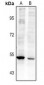 Anti-RASGEF1A Antibody