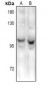 Anti-HPC2 Antibody