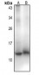 Anti-CCL18 Antibody