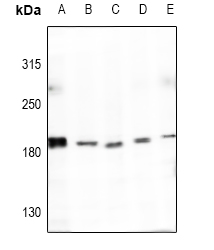 Anti-Collagen 4 alpha 4 Antibody