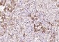 PTOV1 Polyclonal Antibody