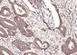 PTOV1 Polyclonal Antibody