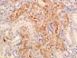 Serine racemase Polyclonal Antibody