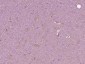 Robo3 Polyclonal Antibody