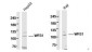 WFS1 Polyclonal Antibody