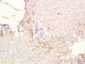 ABCB6 Polyclonal Antibody