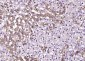 ABCB6 Polyclonal Antibody