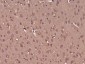 PKIB Polyclonal Antibody