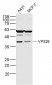 VPS26 Polyclonal Antibody