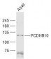 PCDHB10 Polyclonal Antibody