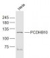 PCDHB10 Polyclonal Antibody