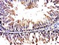 CCDC73 Polyclonal Antibody