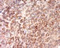 CEP192 Polyclonal Antibody