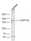 CEP192 Polyclonal Antibody