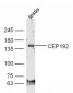 CEP192 Polyclonal Antibody