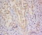 C8orf72 Polyclonal Antibody