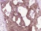 Calpain 2 Polyclonal Antibody