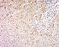 FRY/C13orf14 Polyclonal Antibody