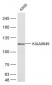 KIAA0649 Polyclonal Antibody