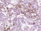 FGFBP1 Polyclonal Antibody