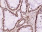 MACROD1 Polyclonal Antibody