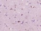 NBPF10 Polyclonal Antibody