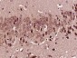 NDUFB5 Polyclonal Antibody