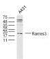 Rarres3 Polyclonal Antibody