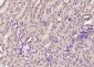 MTA3 Polyclonal Antibody