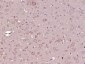 Tyrosine Hydroxylase Polyclonal Antibody