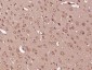 Tyrosine Hydroxylase Polyclonal Antibody