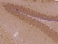 PRCC/Papillary renal cell carcinoma Polyclonal Antibody