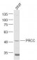 PRCC/Papillary renal cell carcinoma Polyclonal Antibody