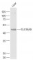 SLC16A9 Polyclonal Antibody