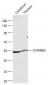 CHRNB2  Polyclonal Antibody