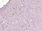 PITX3 Polyclonal Antibody